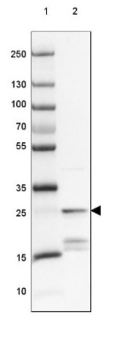 Protein Phosphatase inhibitor 1 Antibody, Novus Biologicals 25 &mu;L, Unlabeled:Antibodies,